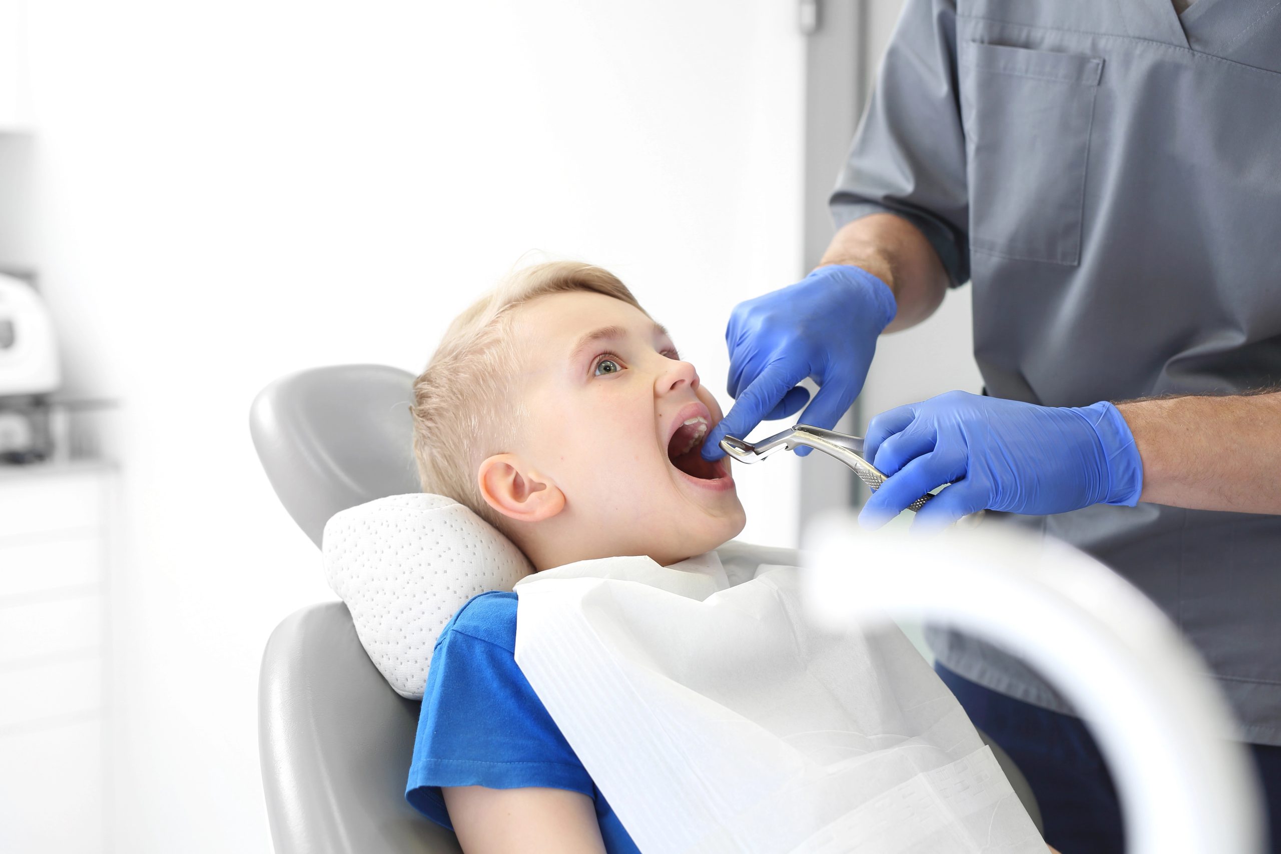 Tooth Extractions