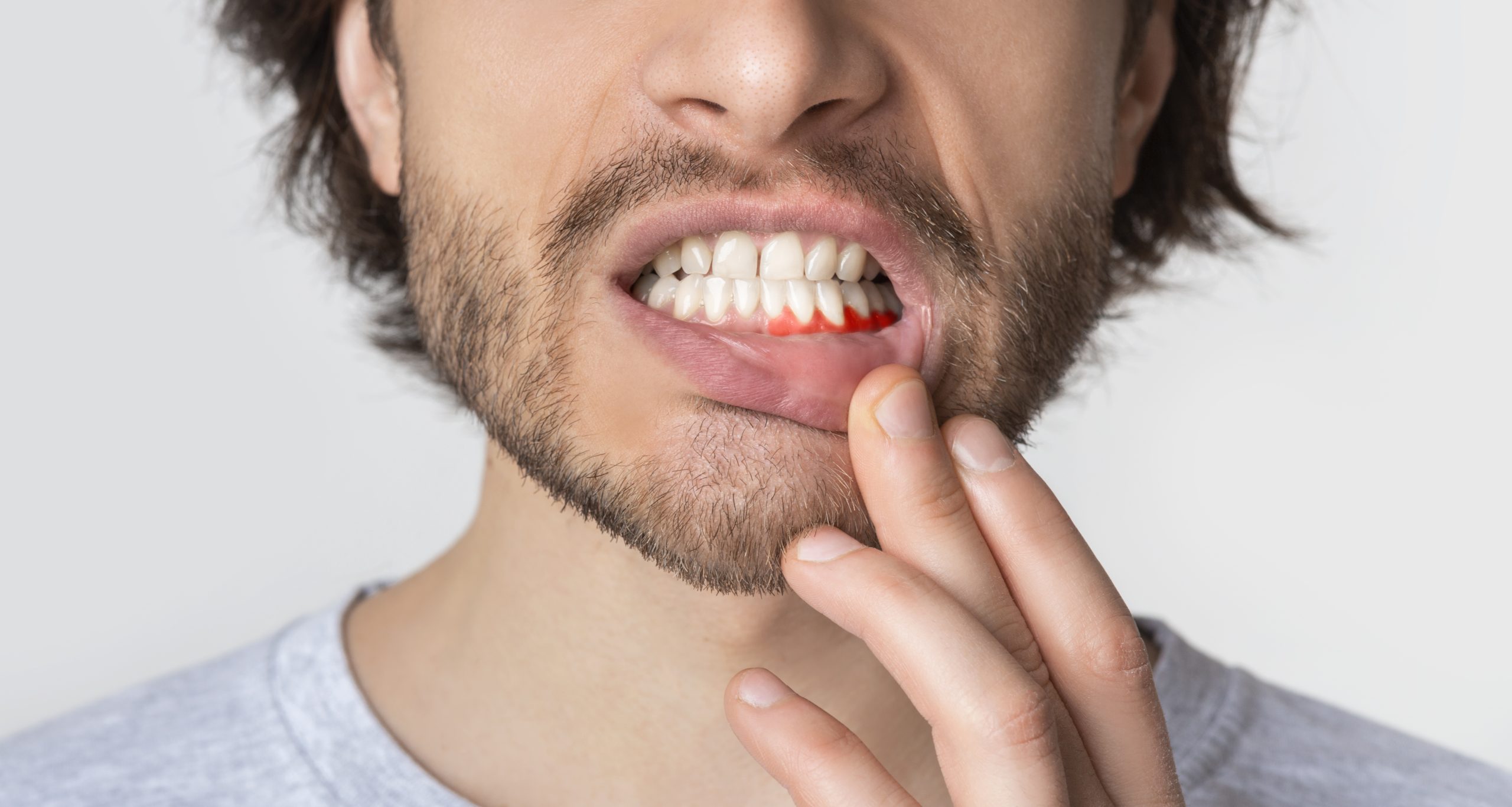 Gum Disease Treatment